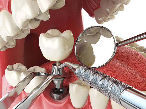Best Emergency Gum Pain Relief  in Lisbon, ND