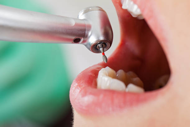 Best Teeth Whitening  in Lisbon, ND
